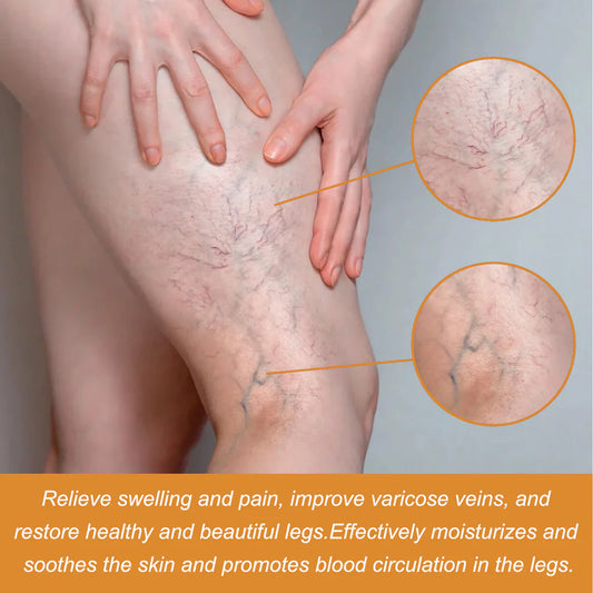 Turmeric Varicose Vein Relief Spray( BUY 1 GET 2 FREE💥 🎁 )